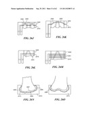 Patient Selectable Joint Arthroplasty Devices and Surgical Tools diagram and image