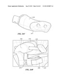 Patient Selectable Joint Arthroplasty Devices and Surgical Tools diagram and image