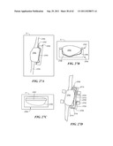 Patient Selectable Joint Arthroplasty Devices and Surgical Tools diagram and image