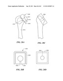 Patient Selectable Joint Arthroplasty Devices and Surgical Tools diagram and image