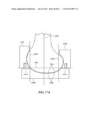 Patient Selectable Joint Arthroplasty Devices and Surgical Tools diagram and image