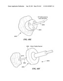 Patient Selectable Joint Arthroplasty Devices and Surgical Tools diagram and image