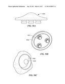 Patient Selectable Joint Arthroplasty Devices and Surgical Tools diagram and image