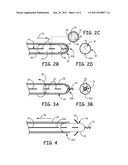 INTRAVASCULAR MEDICAL DEVICE diagram and image