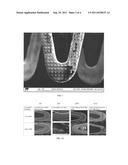 SURFACE TREATED BIOERODIBLE METAL ENDOPROSTHESES diagram and image