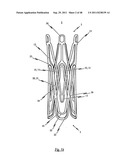 MEDICAL DEVICE FOR TREATING A HEART VALVE INSUFFICIENCY diagram and image