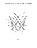 MEDICAL DEVICE FOR TREATING A HEART VALVE INSUFFICIENCY diagram and image