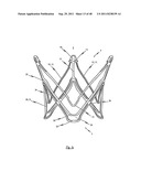 MEDICAL DEVICE FOR TREATING A HEART VALVE INSUFFICIENCY diagram and image