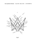 MEDICAL DEVICE FOR TREATING A HEART VALVE INSUFFICIENCY diagram and image