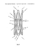 MEDICAL DEVICE FOR TREATING A HEART VALVE INSUFFICIENCY diagram and image