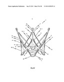 MEDICAL DEVICE FOR TREATING A HEART VALVE INSUFFICIENCY diagram and image