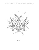 MEDICAL DEVICE FOR TREATING A HEART VALVE INSUFFICIENCY diagram and image