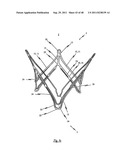 MEDICAL DEVICE FOR TREATING A HEART VALVE INSUFFICIENCY diagram and image