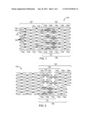 Bifurcated Stent with Variable Length Branches diagram and image