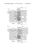 Bifurcated Stent with Variable Length Branches diagram and image