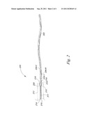 ANNULOPLASTY DEVICE diagram and image