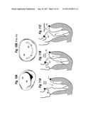 MITRAL ANNULOPLASTY RINGS WITH SEWING CUFF diagram and image