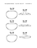 MITRAL ANNULOPLASTY RINGS WITH SEWING CUFF diagram and image