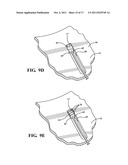 CYLINDER HEAD COMPRESSION SENSOR GASKET ASSEMBLY, METHOD OF CONSTRUCTION     THEREOF AND METHOD OF SERVICING A PRESSURE SENSOR ASSEMBLY IN A CYLINDER     HEAD COMPRESSION SENSOR GASKET ASSEMBLY diagram and image