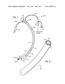 TRACHEAL TUBE WITH SCAFFOLDING-SUPPORTED WALL diagram and image