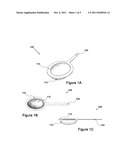 APPARATUS FOR COLLECTING KIDNEY STONES diagram and image