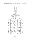 Noise suppression by adaptive speed regulation of towed marine geophysical     streamer diagram and image