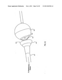 ORTHOVOLTAGE RADIOTHERAPY diagram and image