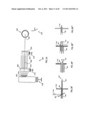 ORTHOVOLTAGE RADIOTHERAPY diagram and image