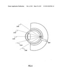 ORTHOVOLTAGE RADIOTHERAPY diagram and image