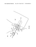 ORTHOVOLTAGE RADIOTHERAPY diagram and image