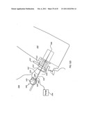 ORTHOVOLTAGE RADIOTHERAPY diagram and image