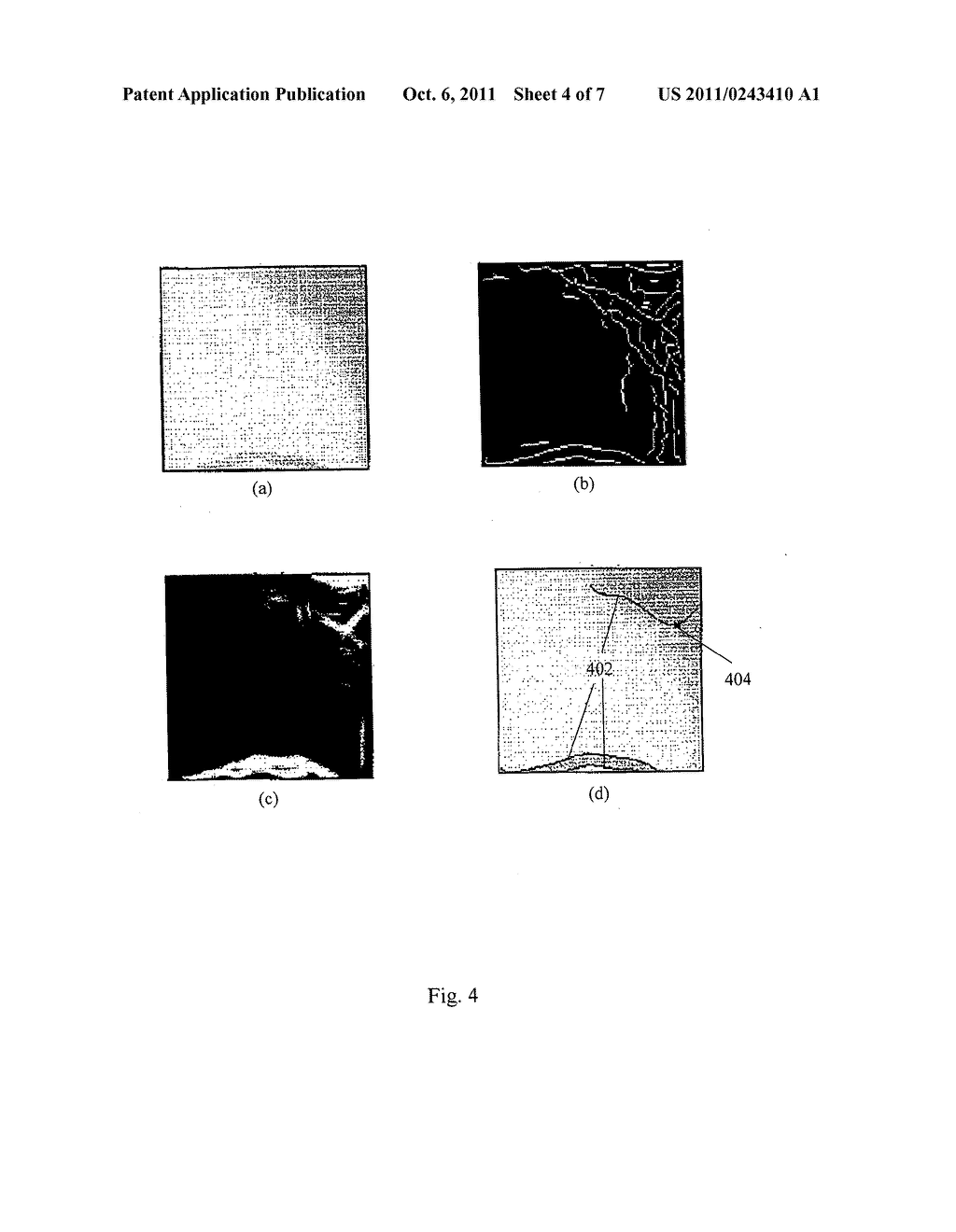 METHOD AND SYSTEM FOR DETERMINING THE POSITION OF AN OPTIC CUP BOUNDARY - diagram, schematic, and image 05