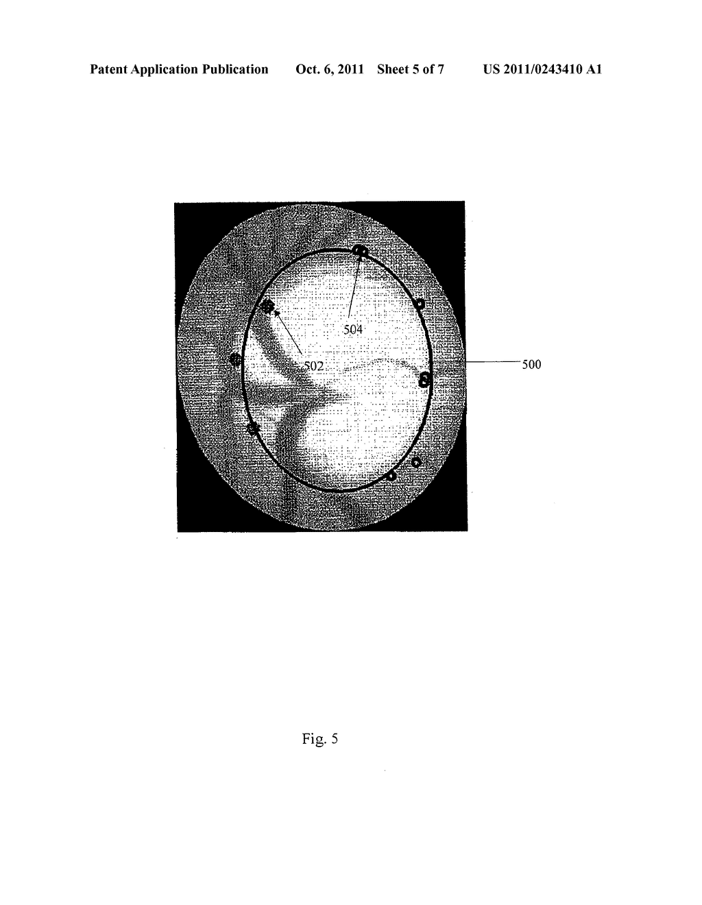 METHOD AND SYSTEM FOR DETERMINING THE POSITION OF AN OPTIC CUP BOUNDARY - diagram, schematic, and image 06