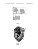 CORONARY ARTERY SELECTIVE CALCIUM ASSIGNMENT USING LOW DOSE CALCIUM     SCORING SCANS diagram and image