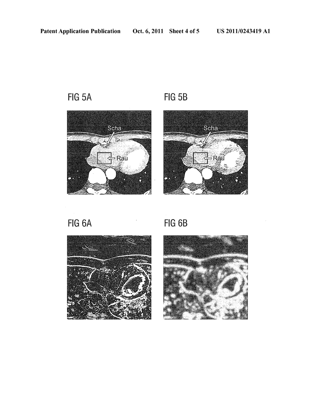 Multisegment Picture Reconstruction For Cardio CT Pictures - diagram, schematic, and image 05