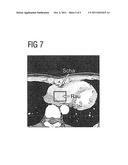 Multisegment Picture Reconstruction For Cardio CT Pictures diagram and image