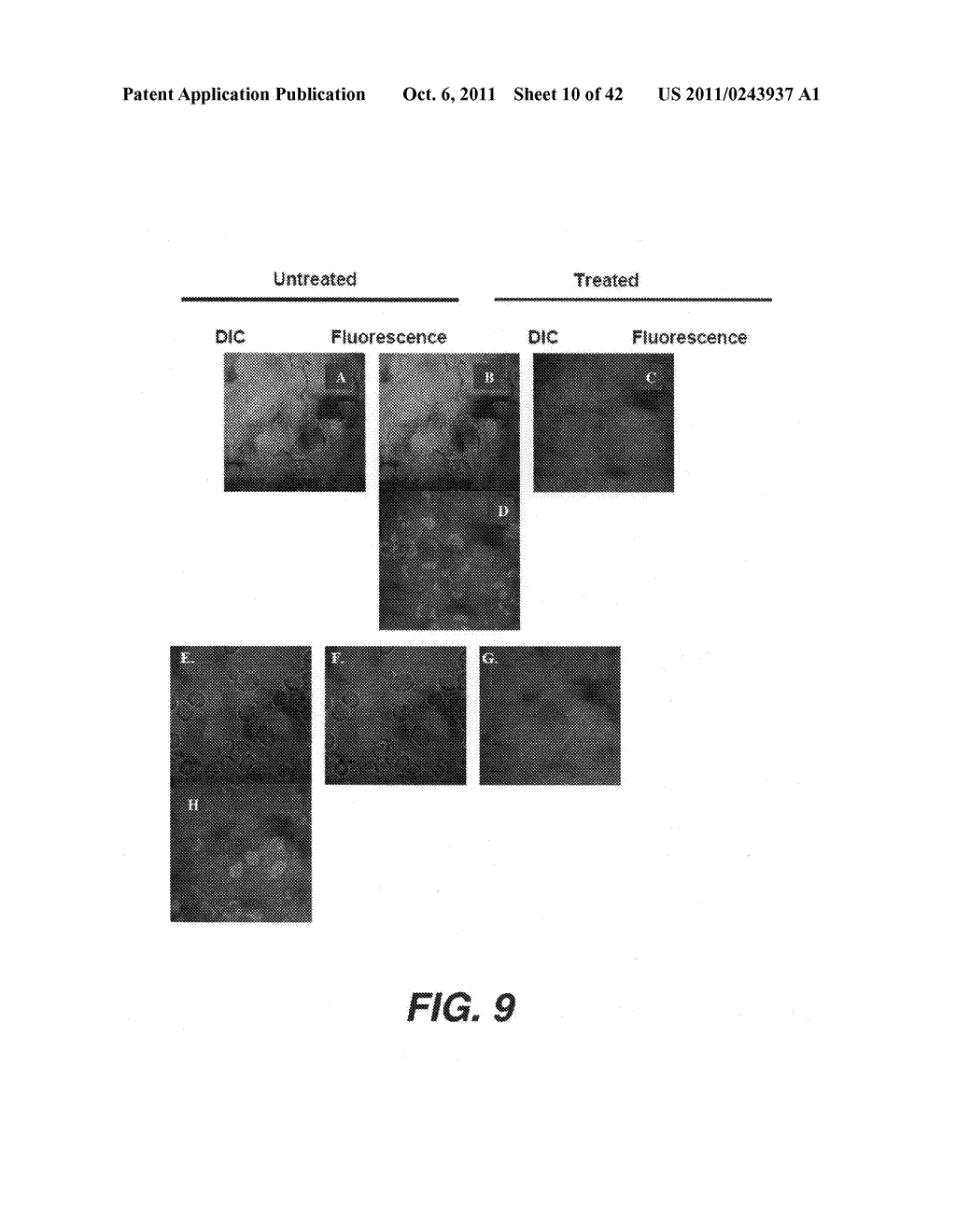 TARGETING PAX2 FOR THE TREATMENT OF BREAST CANCER - diagram, schematic, and image 11