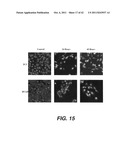 TARGETING PAX2 FOR THE TREATMENT OF BREAST CANCER diagram and image