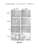 TARGETING PAX2 FOR THE TREATMENT OF BREAST CANCER diagram and image