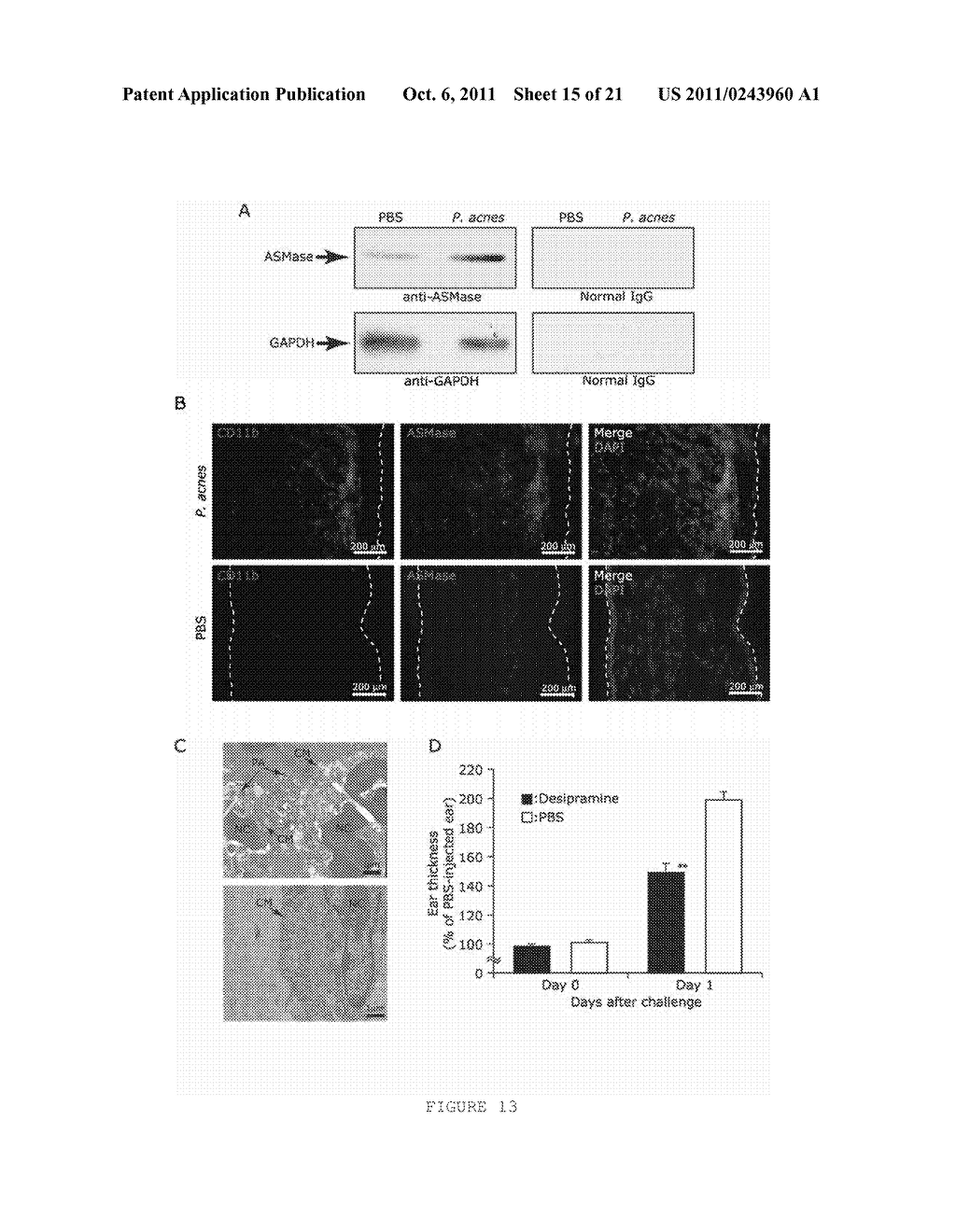 METHODS AND COMPOSITIONS FOR TREATING P. ACNES - diagram, schematic, and image 16