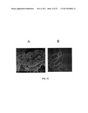 MESOPOROUS MATERIAL EXCIPIENTS FOR POORLY AQUEOUS SOLUBLE INGREDIENTS diagram and image