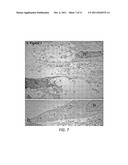 VOLUME EXCLUSION AGENT TO ENHANCE FORMATION OF EXTRACELLULAR MATRIX diagram and image