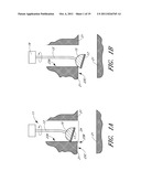 BURR REMOVAL APPARATUS diagram and image