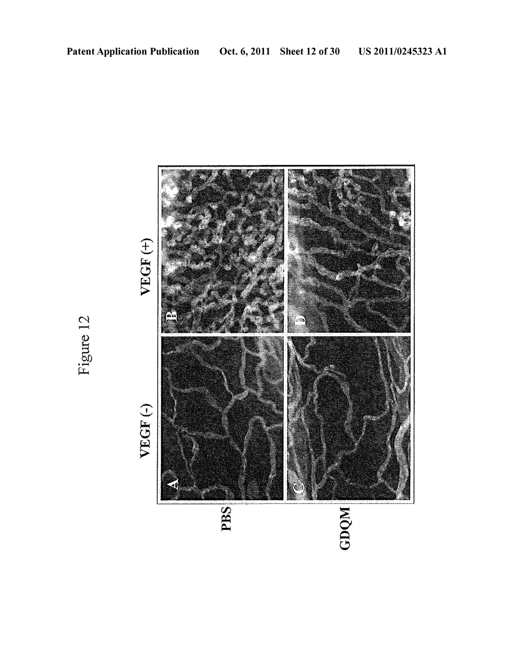 RIG-Like Helicase Innate Immunity Inhibits VEGF-Induced Tissue Responses - diagram, schematic, and image 13