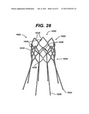 INJECTABLE FORMULATIONS OF TAXANES FOR CAD TREATMENT diagram and image