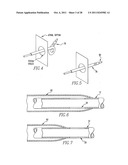 Method and System for Closed Chest Blood Flow Support diagram and image