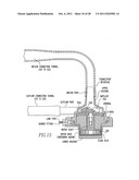 Method and System for Closed Chest Blood Flow Support diagram and image