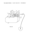 INTEGRATED TANK FILTER FOR A MEDICAL THERAPEUTIC DEVICE diagram and image