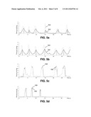 METHODS AND SYSTEMS FOR ANALYSING RESUSCITATION diagram and image