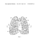 IMPROVED MONITOR OF HEART FAILURE USING BIOIMPEDANCE diagram and image